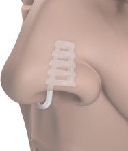 Load image into Gallery viewer, The Original Acusnore Air Flow Nose Vents – Breathe Better, Sleep Deeper