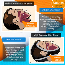 Load image into Gallery viewer, The Original Acusnore Anti-Snore Chin Strap
