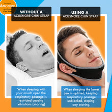 Load image into Gallery viewer, The Original Acusnore Anti-Snore Chin Strap