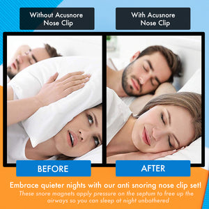 Acusnore Anti Snore Magnetic Nose Clip