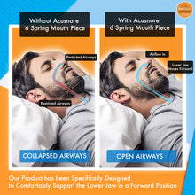 Load image into Gallery viewer, Acusnore Anti Snore 6 Spring Mouth Piece