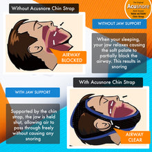 Load image into Gallery viewer, Acusnore Anti Snore Double Support &quot;Max Action&quot; Chin Strap