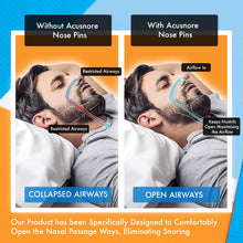 Load image into Gallery viewer, Acusnore Air Flow Nose Pins - 5 Options
