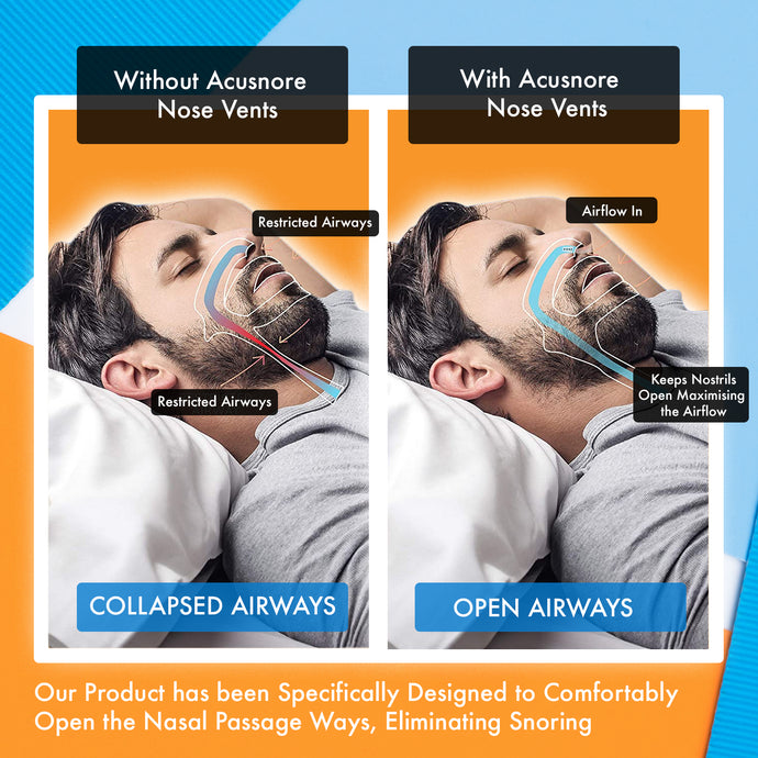 The Original Acusnore Air Flow Nose Vents – Breathe Better, Sleep Deeper